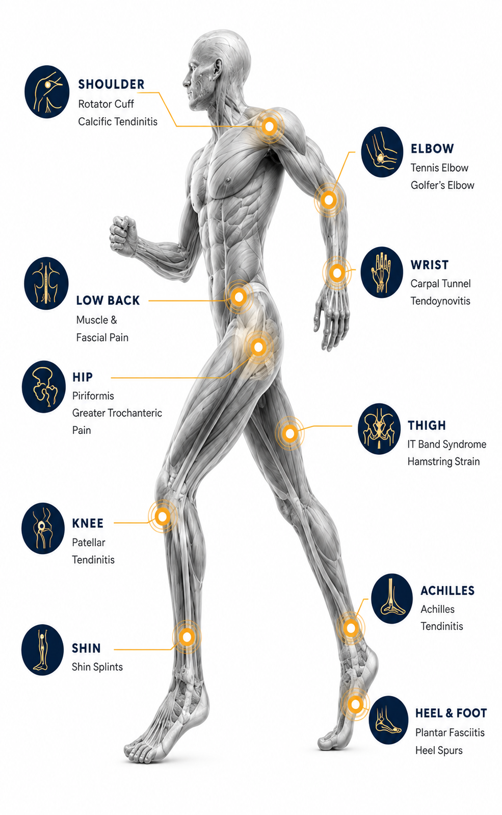 Common conditions treated with focused shockwave therapy